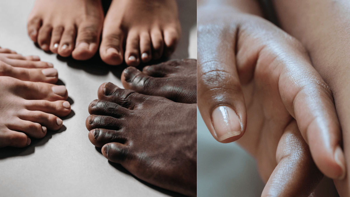 Nail Health Unveiled: Your Nails’ Clues to Overall&nbsp;Wellness